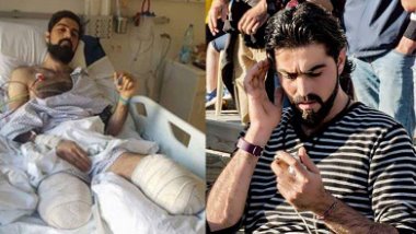 Genç Kürt mülteci, hayat kurtarırken trenin altında kaldı