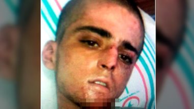 Narkoz altındayken 'YPG' dediği için tutuklandı