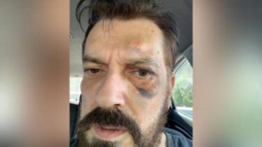 Saldırıya uğrayan SONAR Araştırma Başkanı: PKK'nin sokak dayağı atacağını sanmıyorum