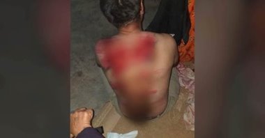 Suçsuz yere günlerce işkence gördü,Kürt çoban, askerler tarafından öldüresiye dövüldü 