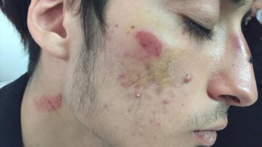 Antalya'da ırkçı saldırıya uğrayan Kürt öğrenciler okulu bırakmak zorunda kaldı