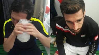 Irkçı saldırıya polisten yanıt: Ani reaksiyon