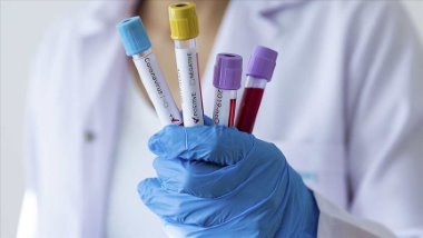 Umutlandıran araştırma: İyileşen hastaların antikorları koronavirüsü tedavi edebilir mi?