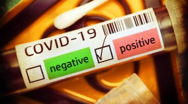 Bilim insanları yanıtladı: Koronavirüs laboratuvarda mı üretildi?