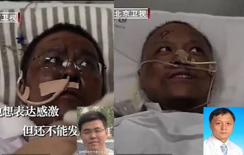 "Koronavirüse yakalanan Vuhanlı doktorların ten rengi değişti" iddiası