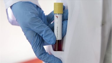 Kürdistan Bölgesi'nde coronavirüs: 3 yeni vaka tespit edildi