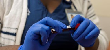 DSÖ’den uyarı: Salgın hız kazanıyor