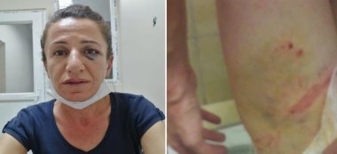 Hak örgütleri: Rojbin Çetin'e işkence yapanlara soruşturma açılsın