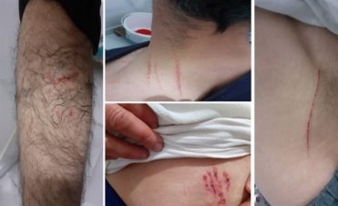 Diyarbakır Valiliği'nden 'köpekle işkence iddiasına'açıklama ...