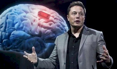Musk: Beyin çipini bu yıl insanlar üzerinde deneyeceğiz