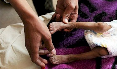 Açlık virüsü çoğalıyor: Dünya genelinde her 1 dakikada 11 insan açlıktan ölüyor