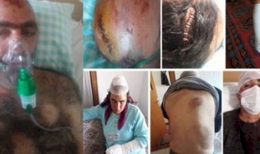 Konya’da Kürt aileye ırkçı saldırı: Sizi Yaşatmayacağız