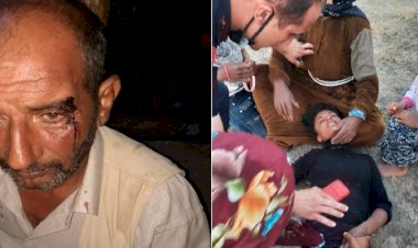 Çorum'da köylüler Urfa'lı mevsimlik işçilere saldırdı