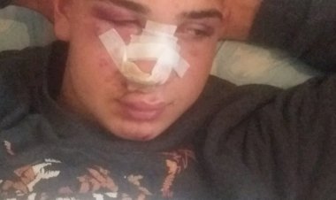 Ankara’da ırkçı saldırı: Pis Kürtler, burası size mezar olacak