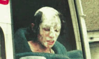 ‘Hayata Dönüş Operasyonu’ndan yaralı kurtulan Birsen Kars hayatını kaybetti