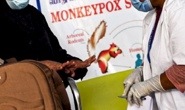 ABD'de maymun çiçeği nedeniyle "acil durum" ilan edildi