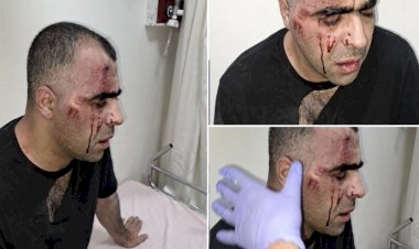 Gazeteci Sinan Aygül: 'Tatvan belediye başkanının korumalarının saldırısına uğradım'