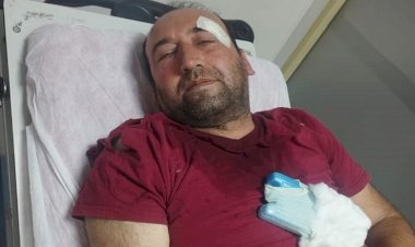 Viranşehirli gazeteci davet edildiği programda darp edildi