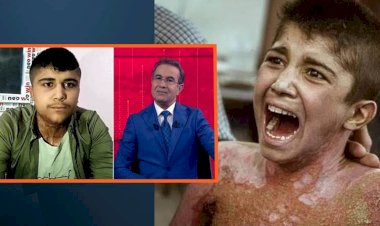 Filistinli diye paylaşılmıştı: Kürdüm, Rojava'da beyaz fosforla yakıldım!