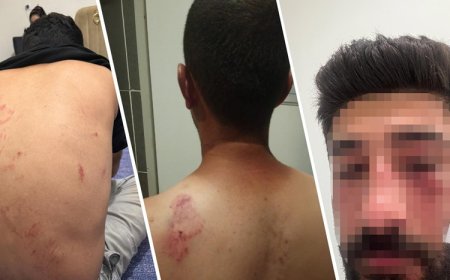 Mersin’de Kürt aileye ırkçı saldırı: 1 kişi yoğun bakımda