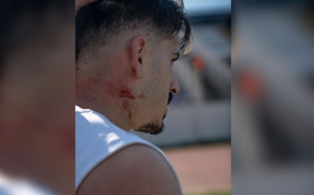 Mardin 1969 Spor’a Gebze deplasmanında saldırı: Futbolcular darbedildi