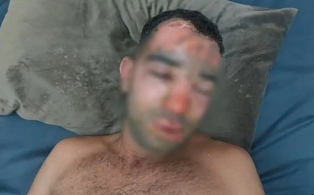 PAK: İran Peşmergelerimize saldırıda beyaz fosfor kullandı